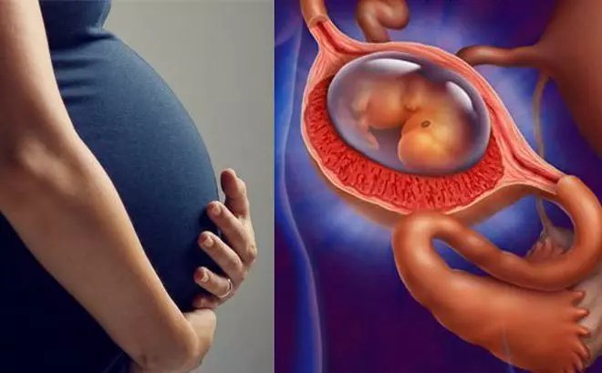 Những người từng mang thai ngoài tử cung không được đưa vào nhóm nghiên cứu